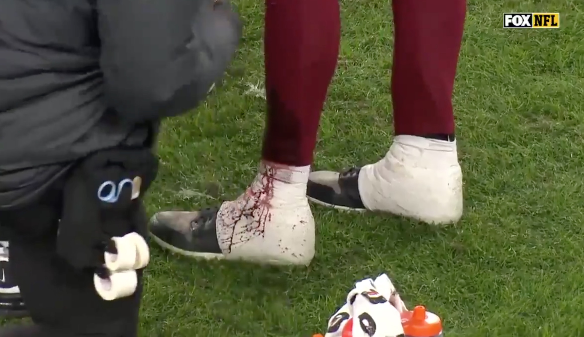 Alex Smith casually gushing blood.