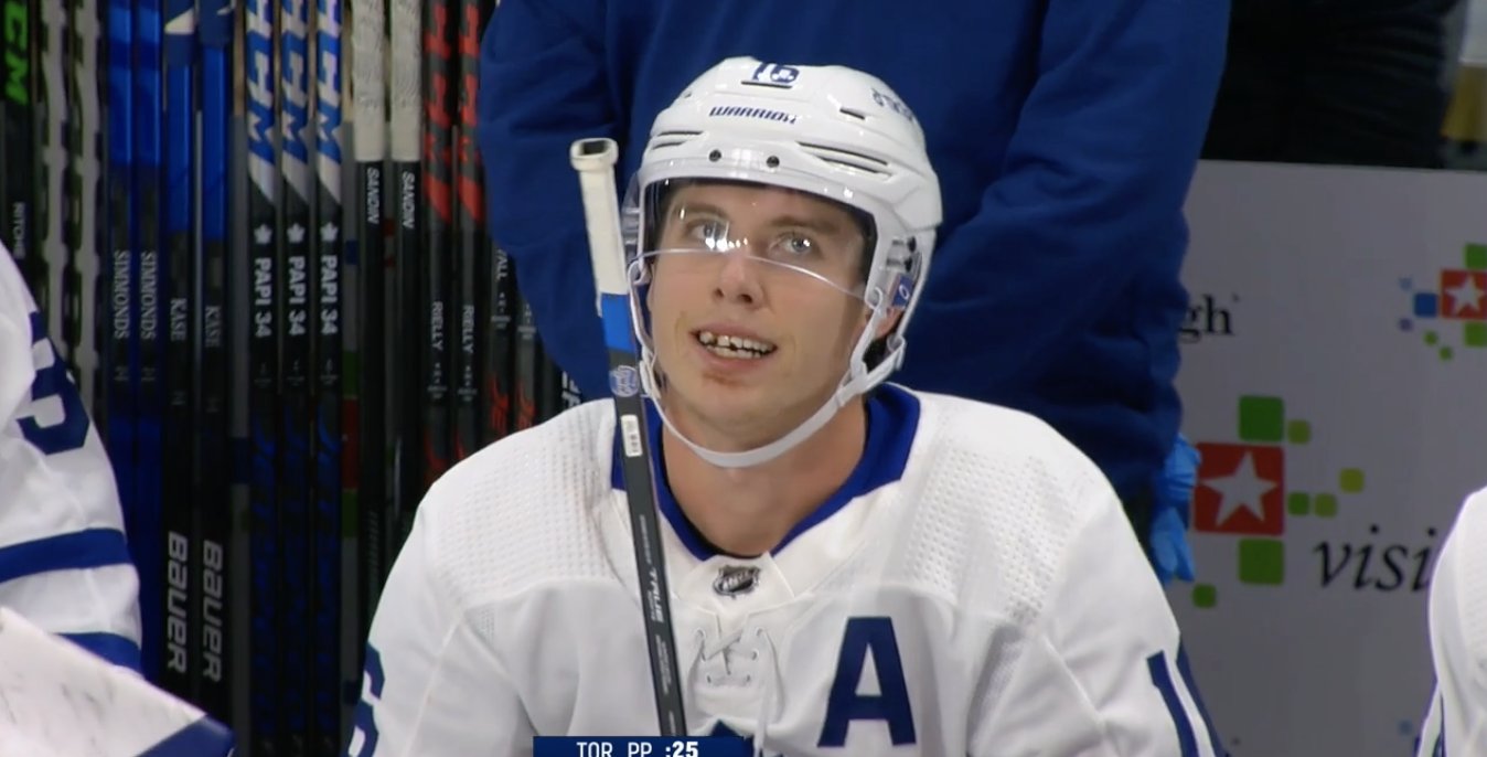 Mitch Marner with missing tooth