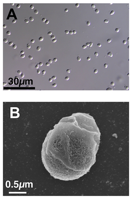 A microscopic photo of a smattering of tailless sperm from an elephantfish, as well as a close-up image of the tailless sperm.