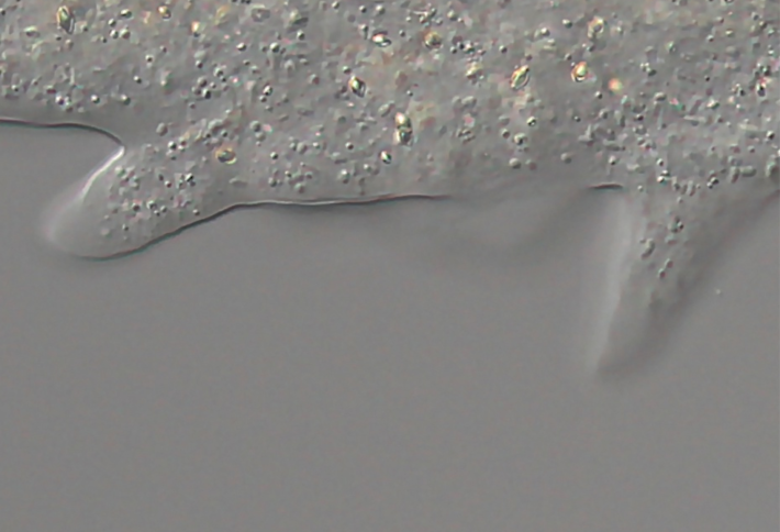 A screenshot of the pseudopodia of an amoeba