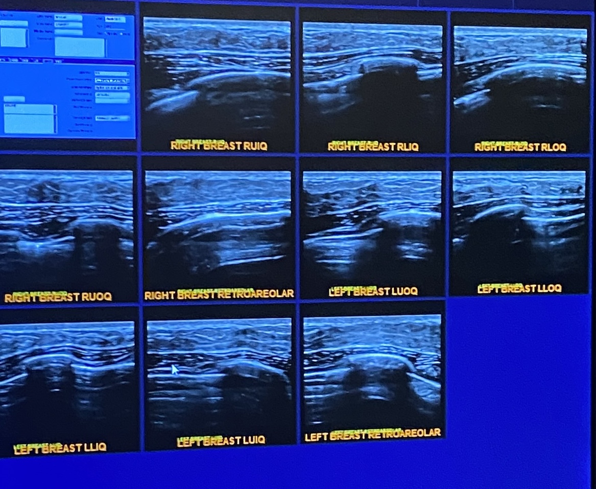 a grid of ultrasound images of my (now former) breasts may they RIP!