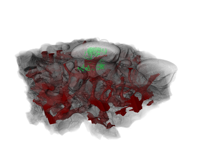 CT scan of the tooth-like-odontode structure from Astrapsis, an ancient jawless vertebrate fish. The tubules (shown in green) are filled with dentine, the same material that makes up the sensitive inner layer of modern teeth. In red is the vascular system which would have housed the nerves in life allowing for sensation to be transmitted.