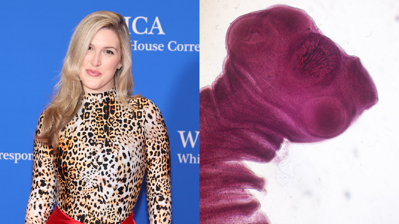 Split image. The lefthand side is Olivia Nuzzi attends the 2023 White House Correspondents' Association Dinner at Washington Hilton on April 29, 2023 in Washington, DC. She's wearing a leopard longsleeve top and has long blonde hair and is smiling tightly at the camera. On the right side is an image of a purple blob of some sort.