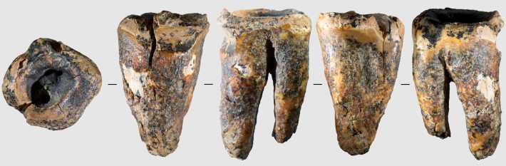 Chagyrskaya 64 molar tooth and its macro-features: General view of the tooth in five projections.