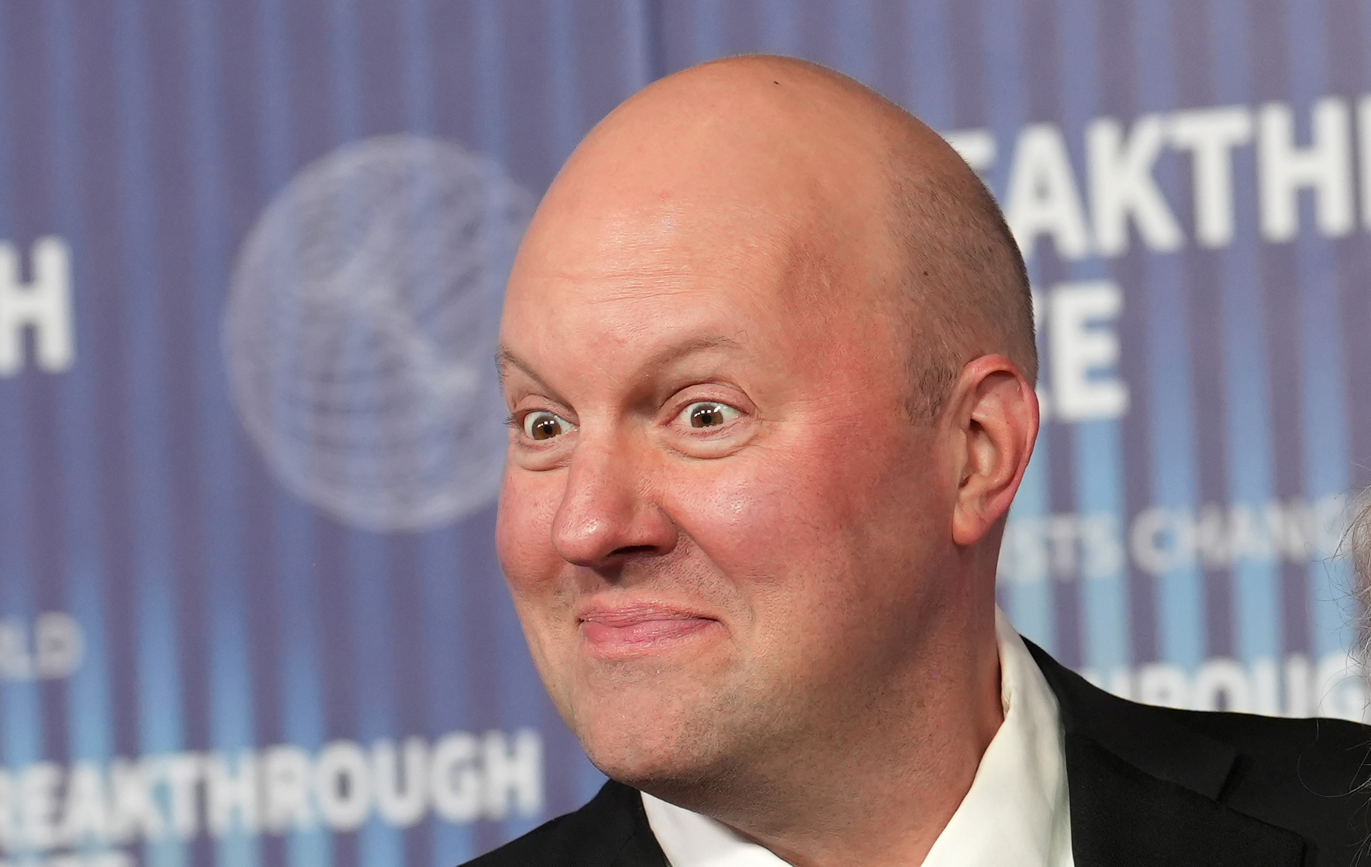 Marc Andreessen's huge egg head.