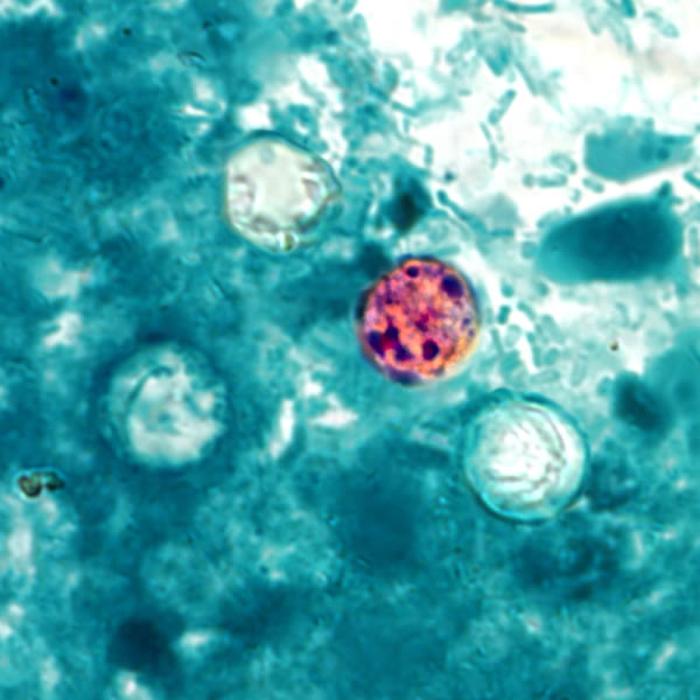 This photomicrograph of a fresh stool sample, which had been prepared using a 10% formalin solution, and stained with modified acid-fast stain, revealed the presence of four Cyclospora cayetanensis oocysts in the field of view.