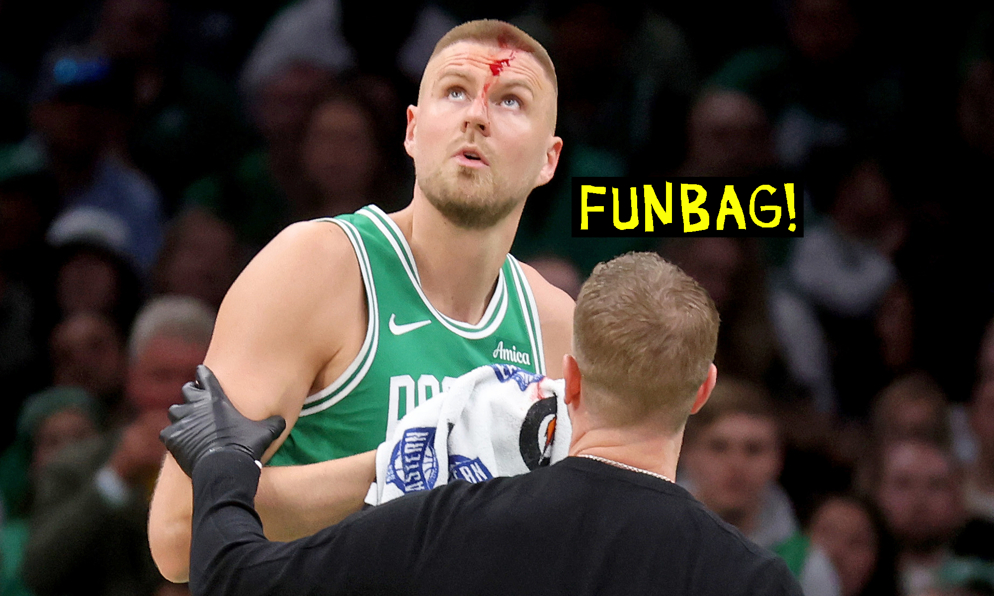 Kristaps Porzingis with blood on his forehead from a collision.