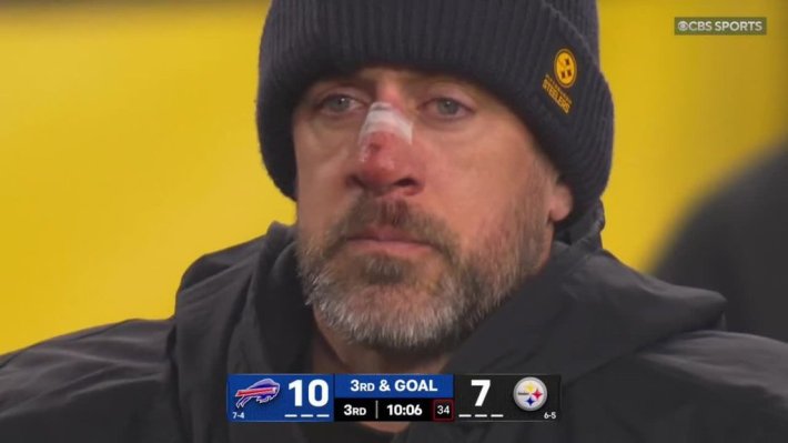 Aaron Rodgers looking all fucked up with a broken nose.